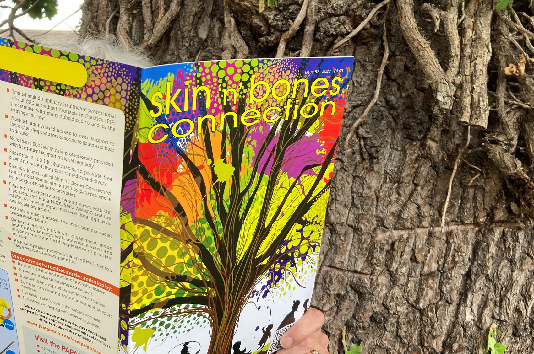 Skin N Bones Connection 57 Journal For Psoriasis And Psoriatic Arthritis Copy