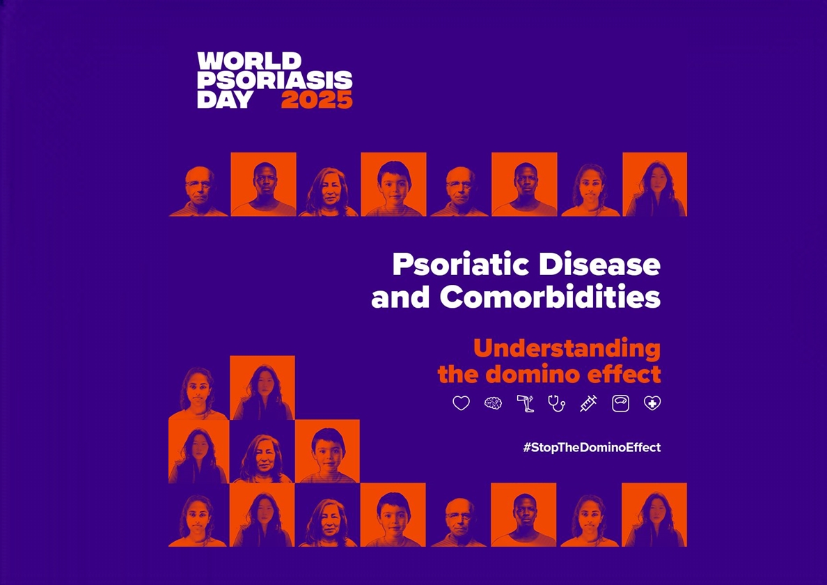World Psoraisis Day 2025 In The UK