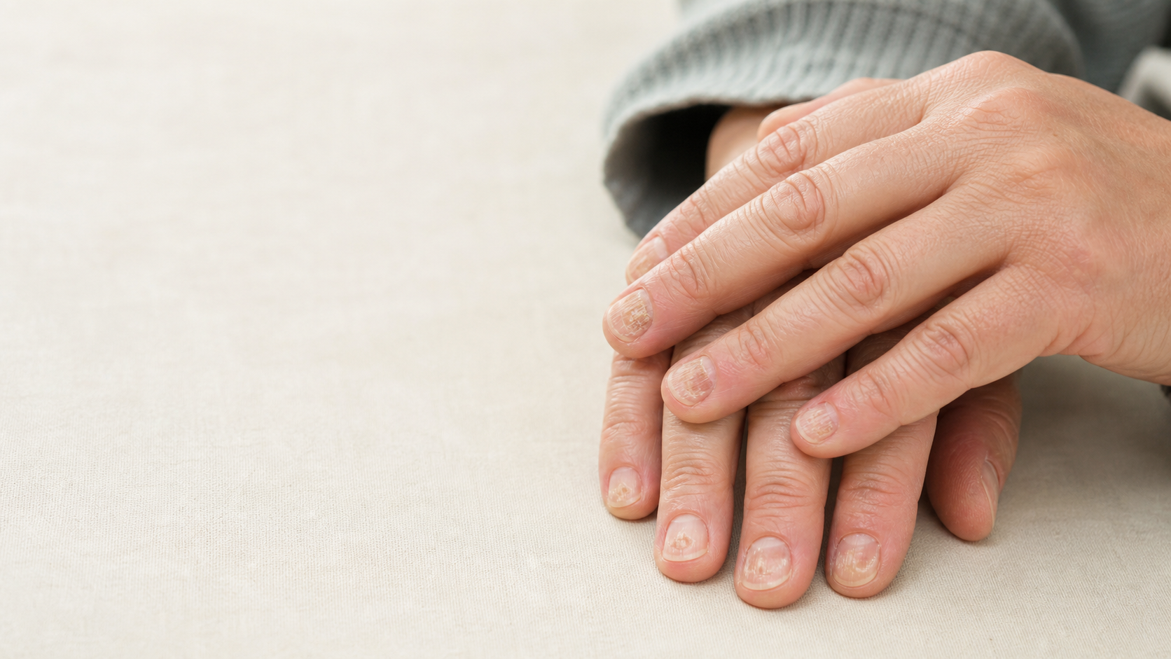 Nail Psoriasis (1)